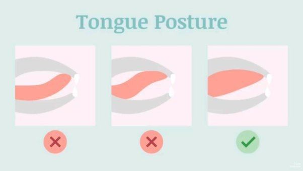 혀뿌리 뮤잉 운동으로 코골이 수면 무호흡증 치료하기 혀뿌리 뮤잉 운동으로 코골이 수면 무호흡증 치료하기